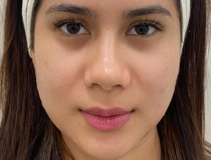 9 Treatments To Get You A Flawless Korean Glass Skin in 2025
